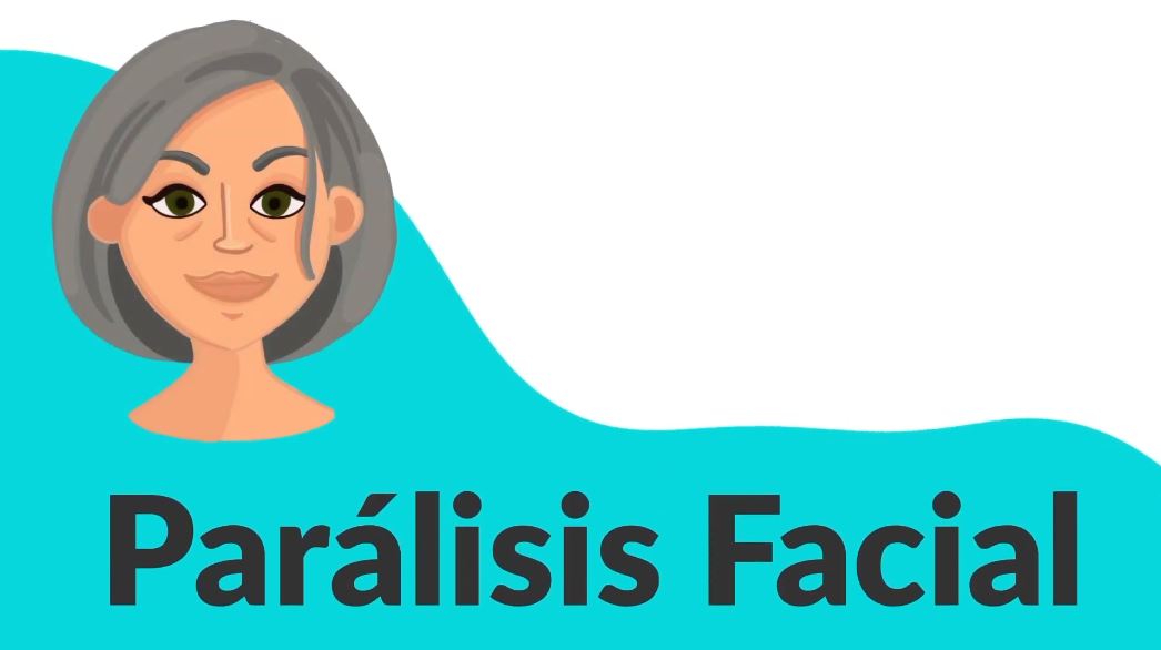 Parálisis facial. Parte I