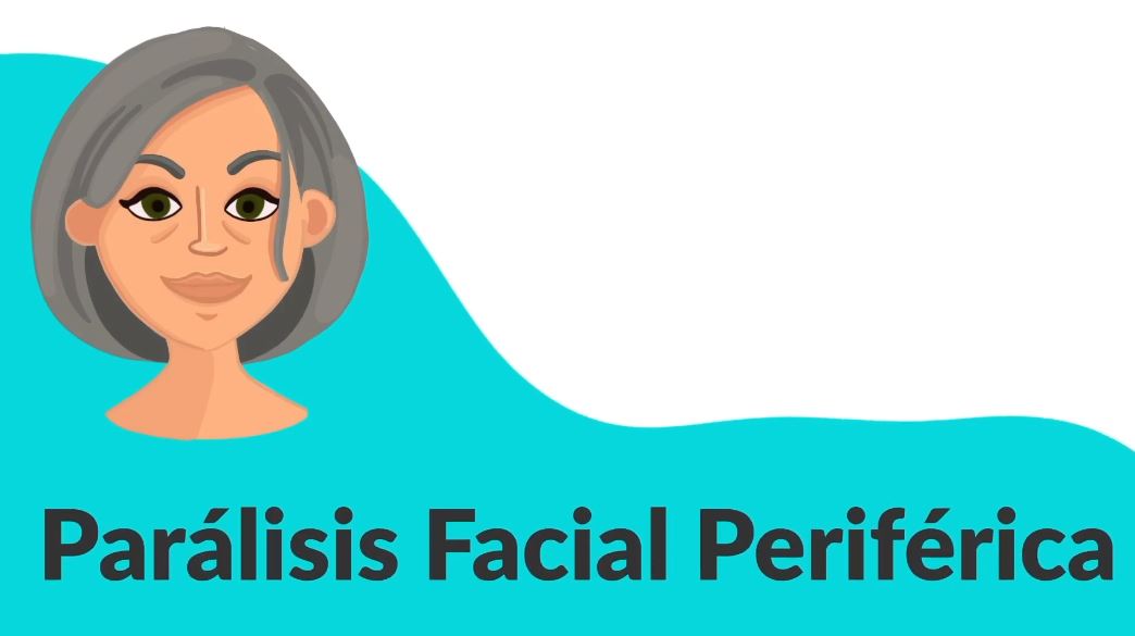 Parálisis facial. Parte II