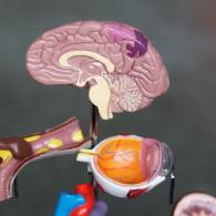 A Comparison of Pediatric- and Adult-Onset Aquaporin-4 Immunoglobulin G-Positive Neuromyelitis Optica Spectrum Disorder: A Review of Clinical and Radiographic Characteristics