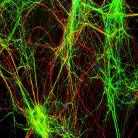 Serum neurofilament light chain for individual prognostication of disease activity in people with multiple sclerosis: a retrospective modelling and validation study