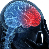 Association of Head Injury With Late-Onset Epilepsy: Results From the Atherosclerosis Risk in Communities Cohort. Neurology
